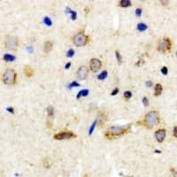 NTSR2 / NTR2 Antibody