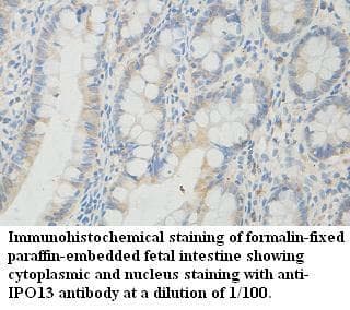 IPO13 / LGL2 Antibody (aa222-420)