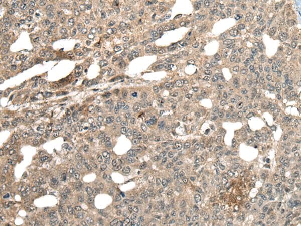 MCPH1 Antibody