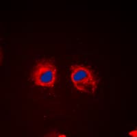 Polyclonal Rabbit anti-Human CTTN / Cortactin Antibody (phospho-Tyr466, IHC, IF, WB)
