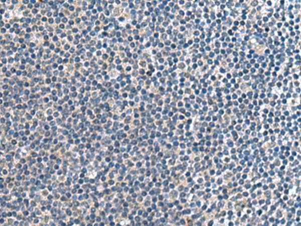 Polyclonal Rabbit anti-Human CNTN4 Antibody (IHC)
