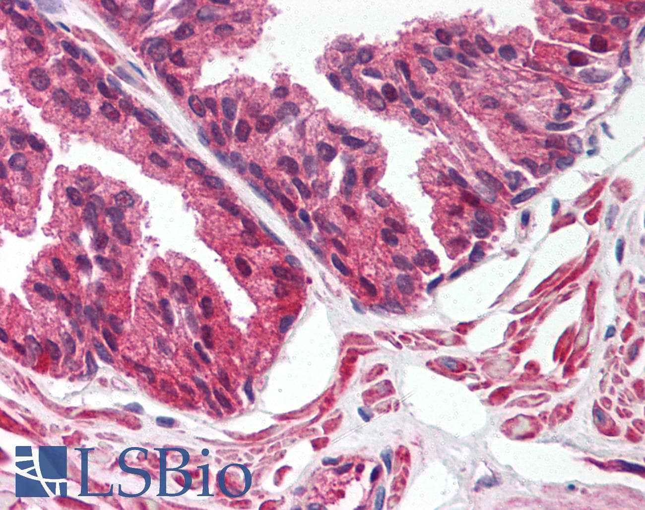 IHC-plus™ Polyclonal Rabbit anti-Human ALOX15B / 15-LOX-2 Antibody (aa161-179, IHC, WB)