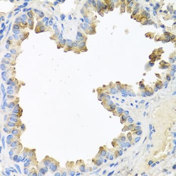 NRG4 Antibody