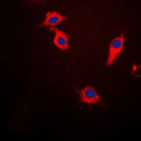 SNCB / Beta-Synuclein Antibody (C-Terminus)