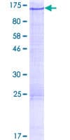Human ALS2CL Protein (Recombinant GST)