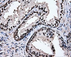 TIPRL / TIP Antibody (clone OTI3D11)