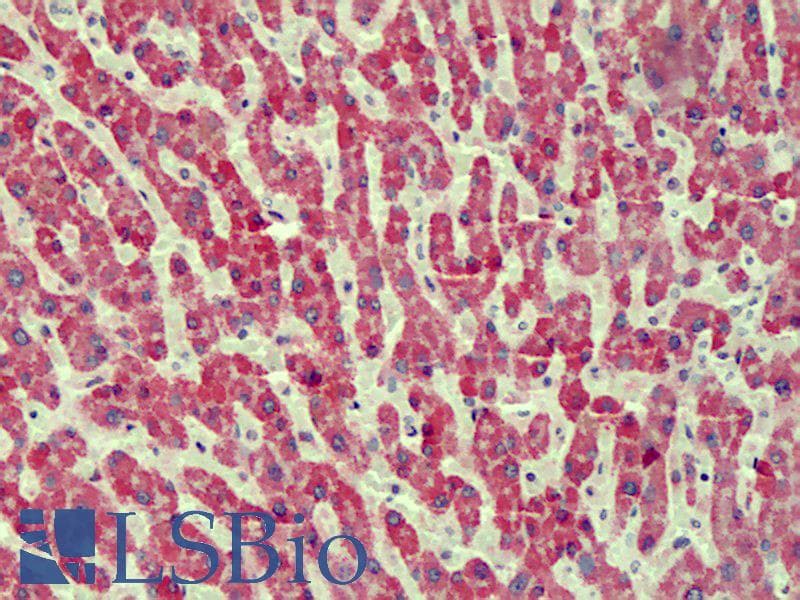 IHC-plus™ ANTXR2 / CMG2 Antibody (aa121-133)