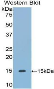UMOD / Uromodulin Antibody (aa32-151, FITC)