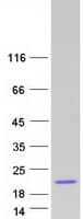 Human EAT2 / SH2D1B Protein (Recombinant Myc-DDK (Flag))