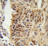 CIRP / CIRBP Antibody (aa145-172)