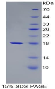 Rabbit TTR / Transthyretin Protein (Recombinant His-T7)