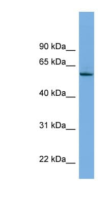 Polyclonal Rabbit anti-Human NLK Antibody (aa431-480, WB)