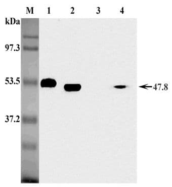 FOXP3 Antibody (clone MF333F)