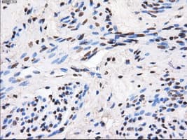 Monoclonal Mouse anti-Human GBE1 Antibody (clone OTI1D11, IHC, IF, WB)