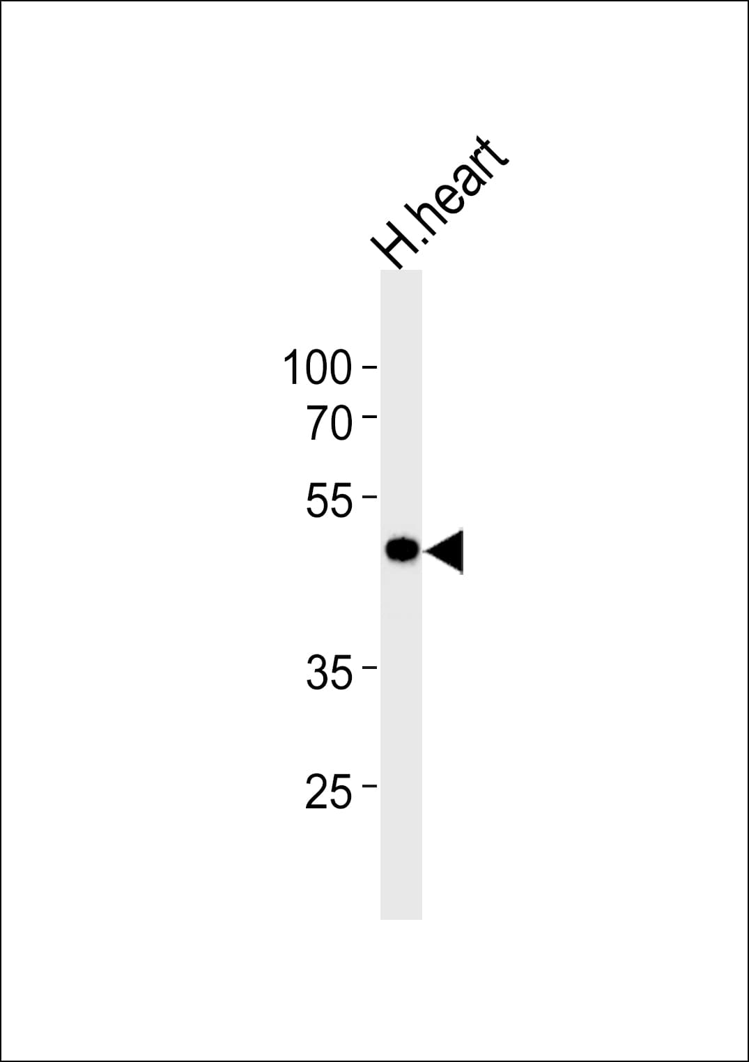 KCNAB1 Antibody (aa15-44)