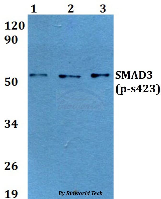 Polyclonal Rabbit anti-Human SMAD3 Antibody (phospho-Ser423, WB)