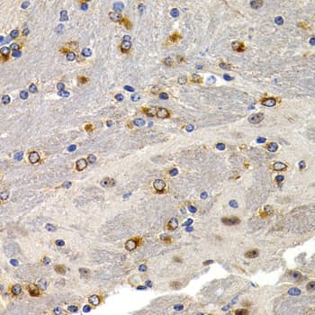 TFF1 / pS2 Antibody
