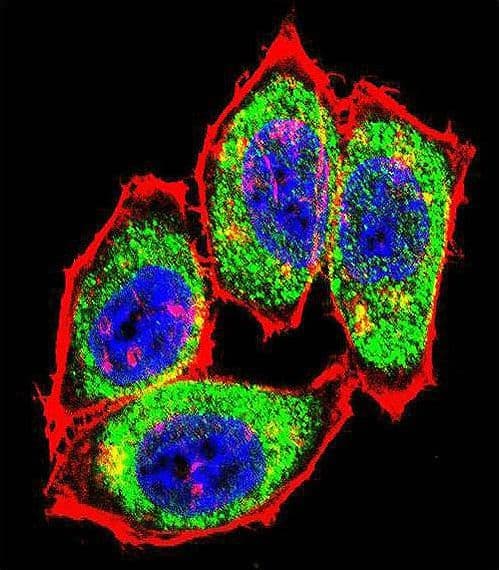 TS / Thymidylate Synthase Antibody (aa265-294)