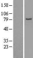 EHHADH / Enoyl-Coa Hydratase Protein (Over-Expression Lysate Myc-DDK (Flag))