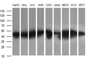Monoclonal Mouse anti-Human PARVA Antibody (clone OTI3H2, IHC, WB)