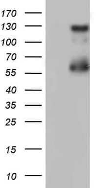GLI / GLI1 Antibody (aa755-1106, clone OTI4D1)