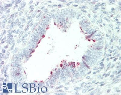 IHC-plus™ MMP7 / Matrilysin Antibody (aa198-247)