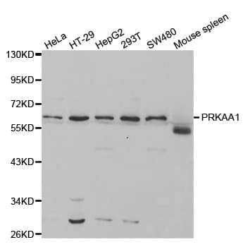 PRKAA1 / AMPK Alpha 1 Antibody