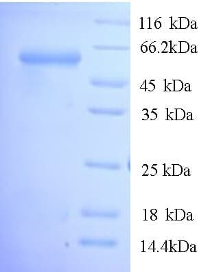 Porphyromonas gingivalis rgpA / Gingipain R1 Protein (Recombinant His)