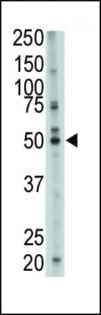 Polyclonal Rabbit anti-Human FDFT1 / Squalene Synthase Antibody (aa1-30, IHC, WB)