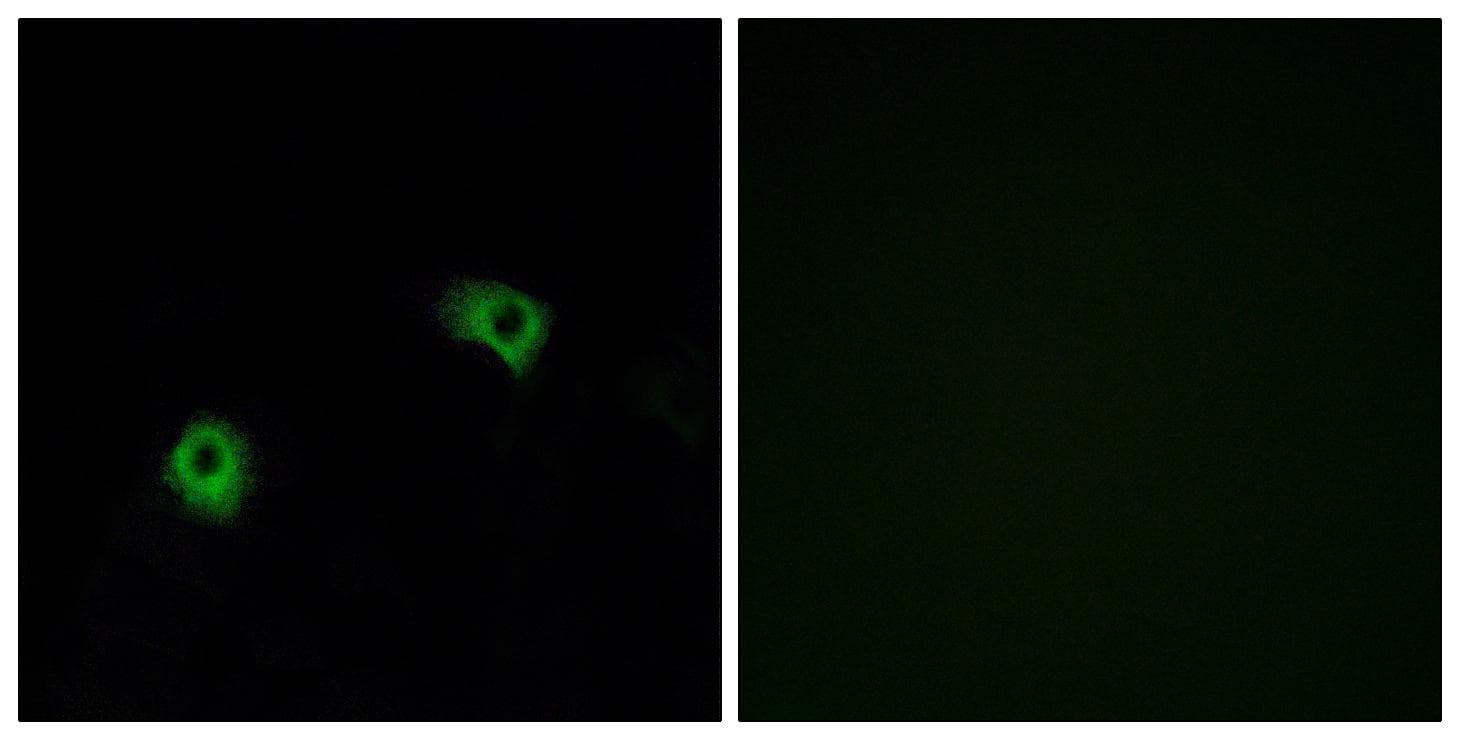 Polyclonal Rabbit anti-Human ADGRF5 / GPR116 Antibody (IHC, IF)
