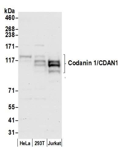 Polyclonal Rabbit anti-Human CDAN1 Antibody (aa1177-1227, WB)