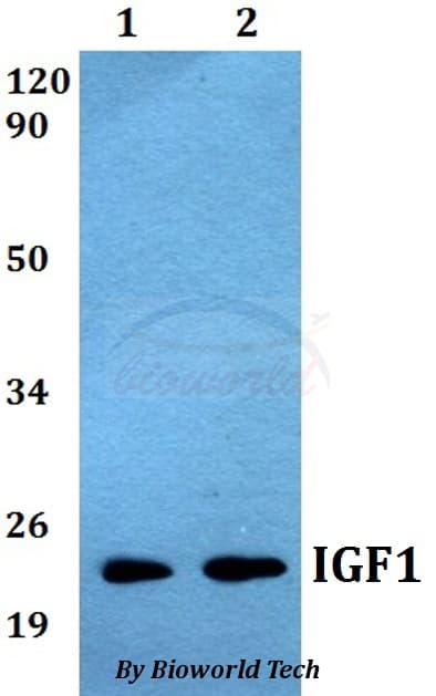 Polyclonal Rabbit anti-Human IGF1 Antibody (WB)