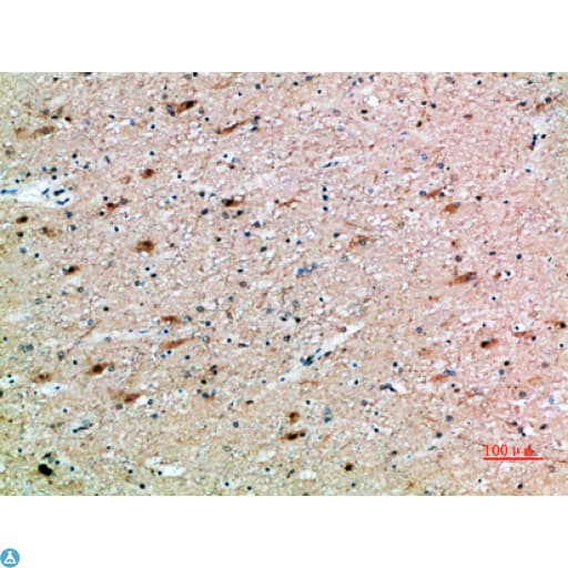 FSHB / FSH Beta Antibody