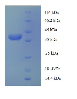 Human AP1S3 Protein (Recombinant GST)