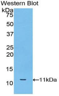 MT3 / Metallothionein 3 Antibody (aa1-68)