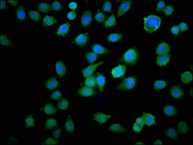 TPT1 / TCTP Antibody