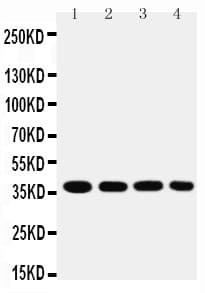 Polyclonal Rabbit anti-Human MT-CO1 / COX1 Antibody (aa501-514, IHC, WB)
