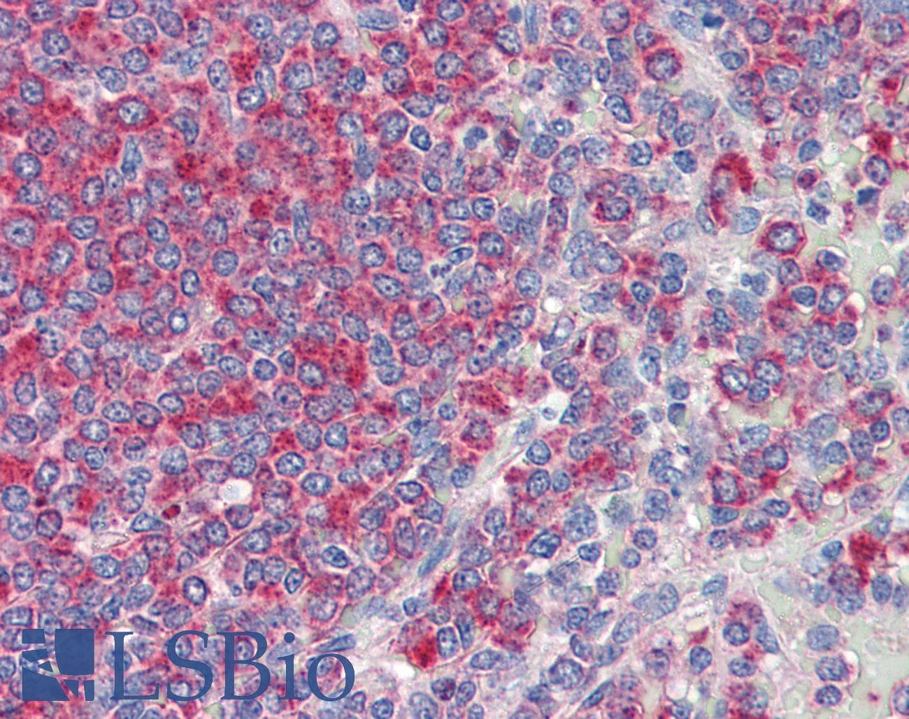IHC-plus™ CD34 Antibody (clone MEC14.7)