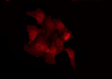 SRC Antibody (phospho-Tyr418)