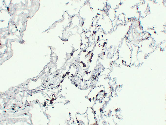 ACP5 / TRAP Antibody (clone ABT-TRAP)