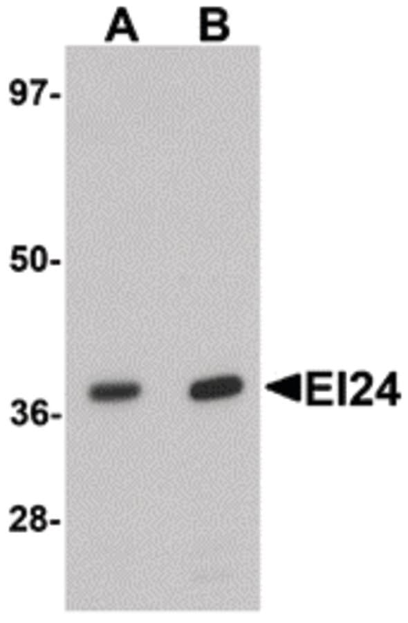 IHC-plus™ PIG8 / EI24 Antibody