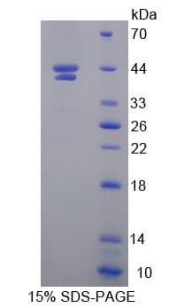 Human HIF1AN Protein (Recombinant His, N-Terminal)