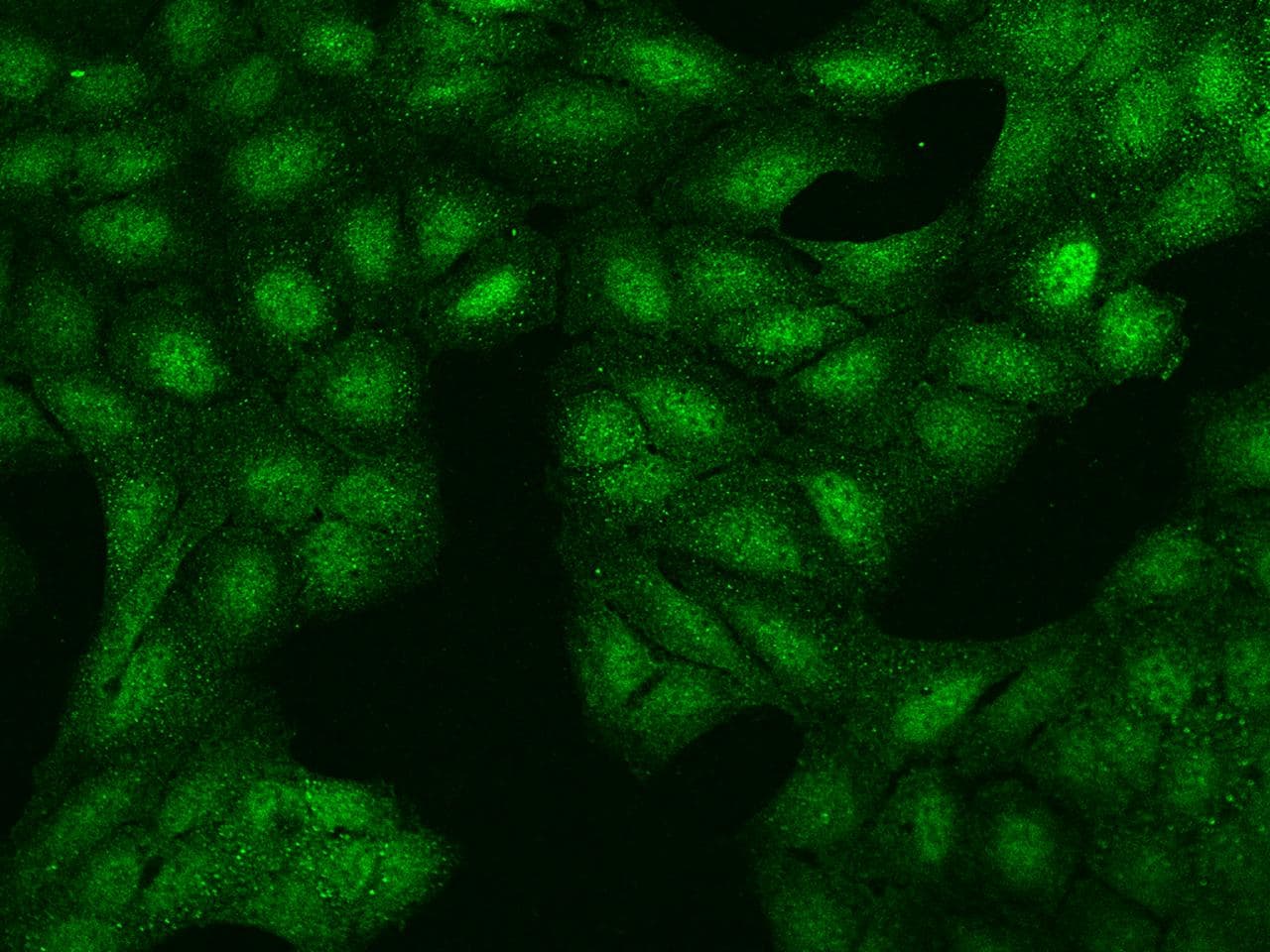 MLLT3 / AF9 Antibody
