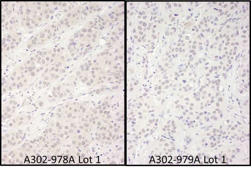DDX56 Antibody (aa300-350)