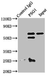 Polyclonal Rabbit anti-Human PSG1 / CD66f Antibody (aa180-419, IHC)