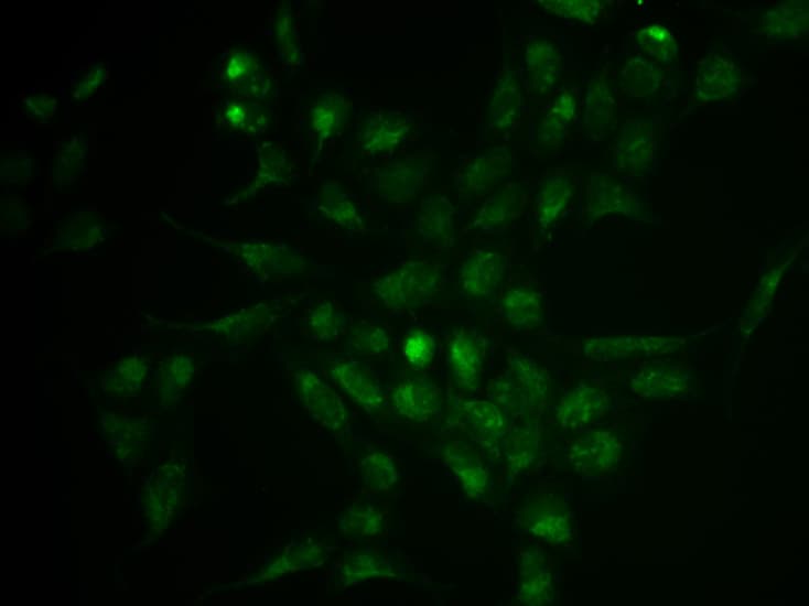 Polyclonal Rabbit anti-Human SELPLG / PSGL-1 / CD162 Antibody (IHC, IF, WB)