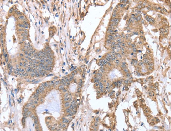 IHC-plus™ ABCB6 Antibody