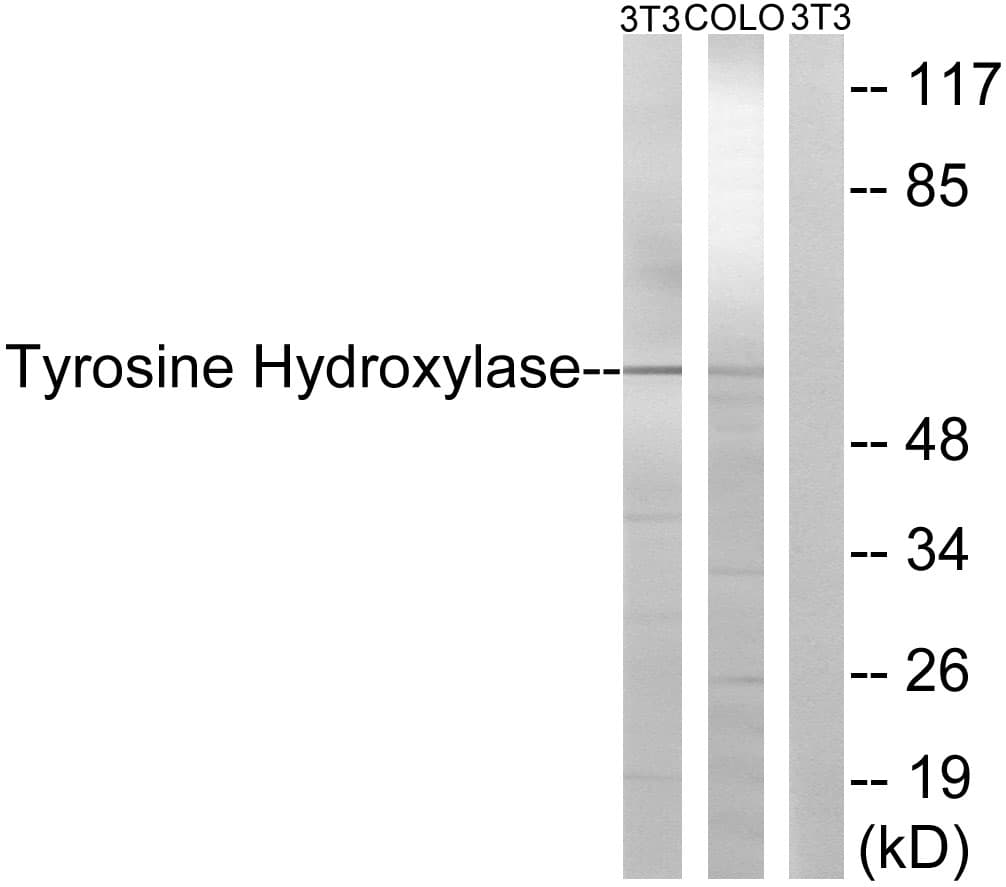 Polyclonal Rabbit anti-Human TH / Tyrosine Hydroxylase Antibody (aa10-59, IHC, IF, WB)