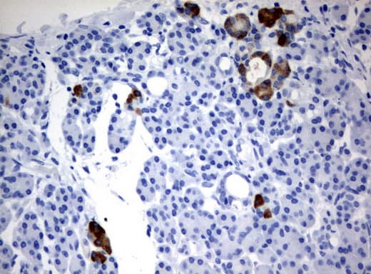 FTCD / 58K Golgi Protein Antibody (clone UMAB122, Carrier-free)