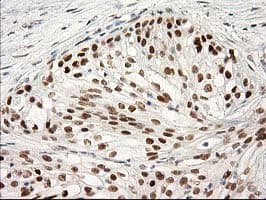 PRKCE / PKC-Epsilon Antibody (clone OTI2A12)